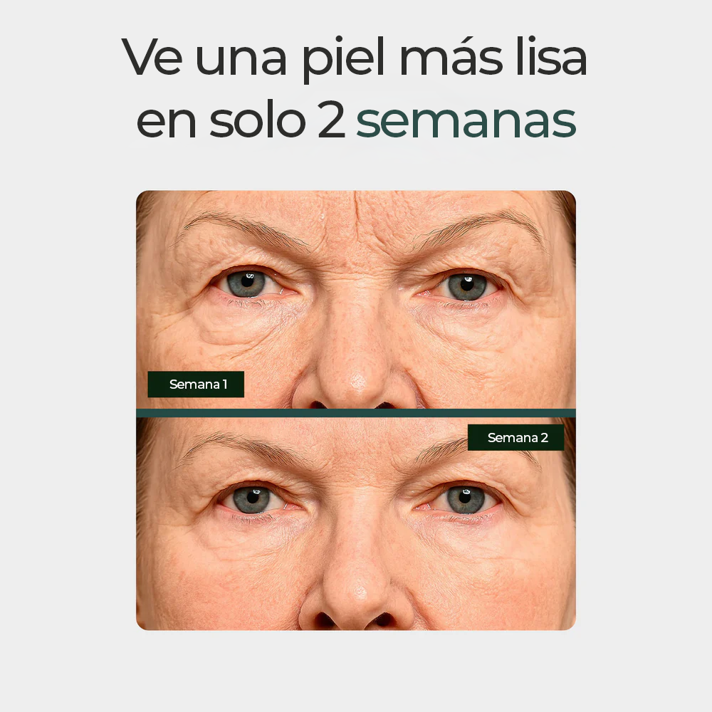 Parches de Silicona para Cicatrices